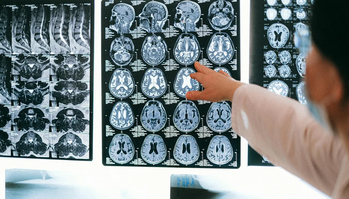 Doctor pointing at CT scan Xrays