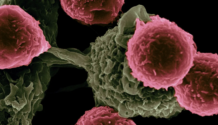 microscopic image of cancer cells